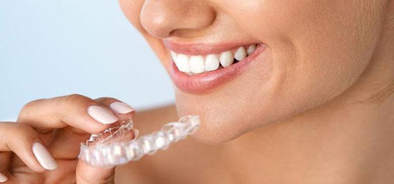 apparecchio per denti a Teramo